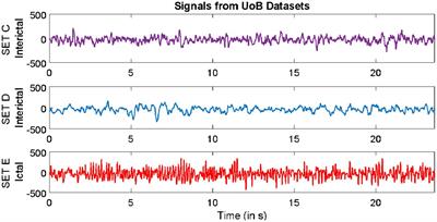 Evolutionary transfer optimization-based approach for automated ictal pattern recognition using brain signals